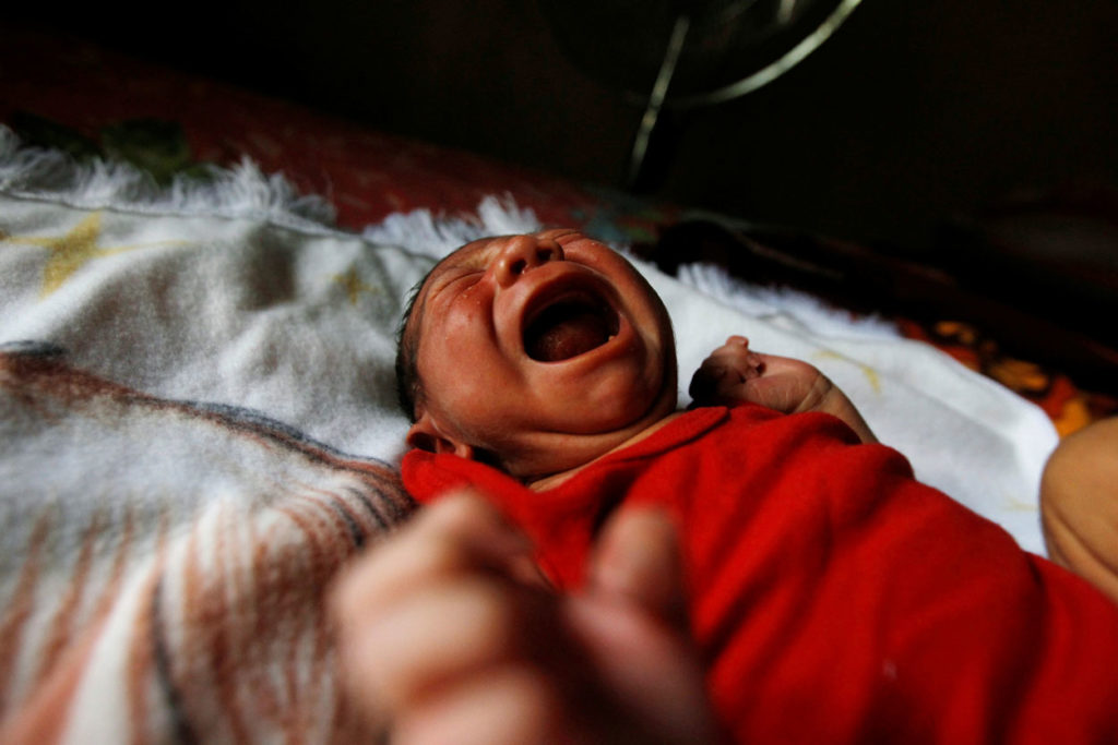 An eight-day old baby in Choluteca, Honduras, was born with microcephaly caused by the Zika virus. (Reuters/Jorge Cabrera/Newscom).
