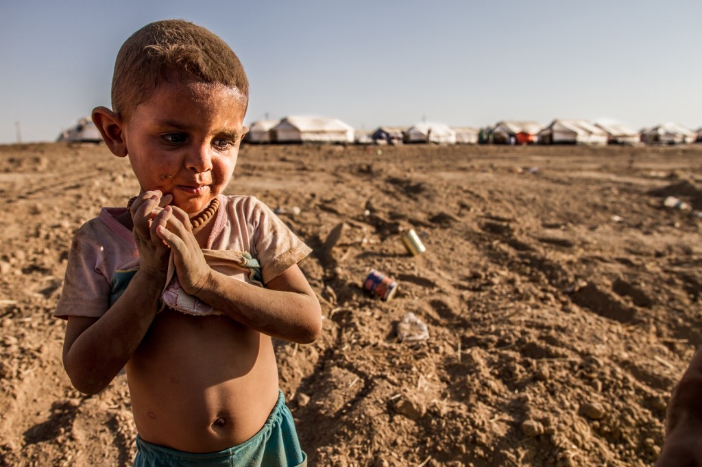 This girl is musing after playing in the dusty area around the camp. (Photo: Sebastian Backhaus/Newscom)