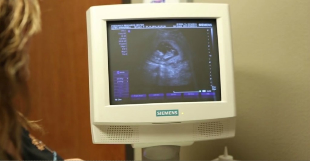 Sonograms are offered at women's care clinics. Shandriell was able to hear the heartbeat of her unborn baby while getting a Sonogram. (Photo: Online for Life) 