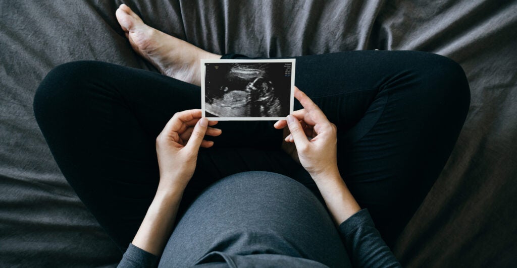 pregnant woman looking at ultrasound photo of her baby